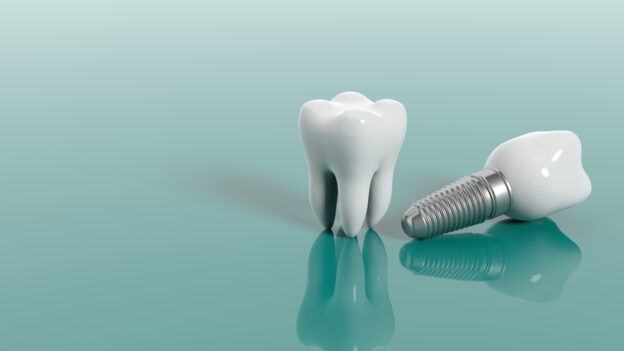 Tooth and dental implant isolated on green background. 3d illustration