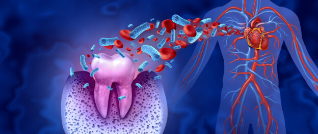 Tooth decay and heart disease as an unhealthy molar with periodontitis due to poor oral hygiene health problem as a bacteria infection in the blood as a concept with inflammation as a 3D illustration on a blue background.