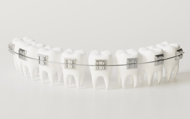 Teeth brace in the white background, 3d rendering. Computer digital drawing.